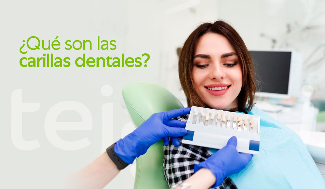 Carillas Dentales en Tacna: ¿Qué Son y Cuándo Son Necesarias?