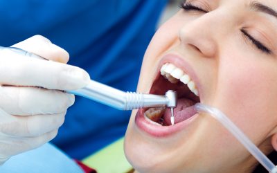 ¿Por qué es importante una limpieza dental cada 6 meses?