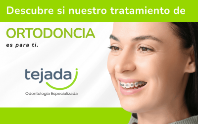 Ortodoncia: ¿Es para ti?