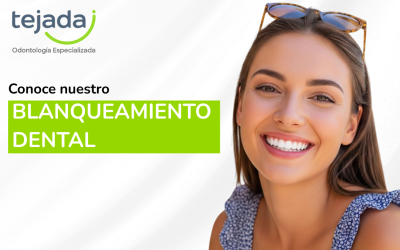 Blanqueamiento dental: todo lo que necesitas saber para recuperar el brillo de tu sonrisa