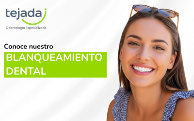 Blanqueamiento dental: todo lo que necesitas saber para recuperar el brillo de tu sonrisa