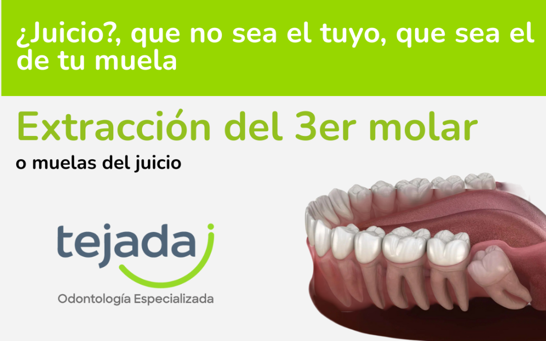 Extracción de Muelas del Juicio o Cirugía del 3er Molar: