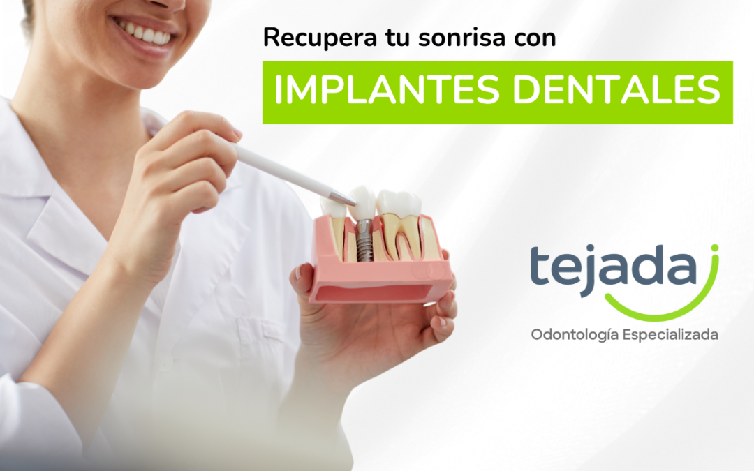 Ventajas de los implantes dentales frente a las prótesis removibles