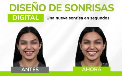 ¡Transforma tu imagen en cuestión de segundos! Diseño de Sonrisa Digital