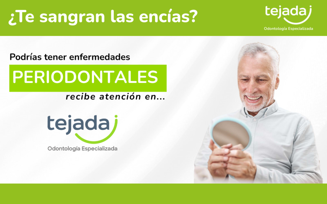 ¿Por qué te sangran las encías? Periodoncia
