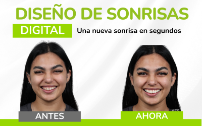 ¡Transforma tu imagen en cuestión de segundos! Diseño de Sonrisa Digital